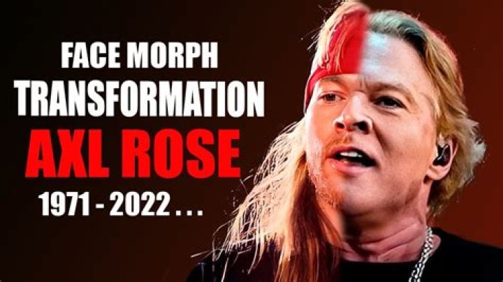 Adelaide Woman Claims Injury After Being Struck In The Face By Axl Rose’s Microphone