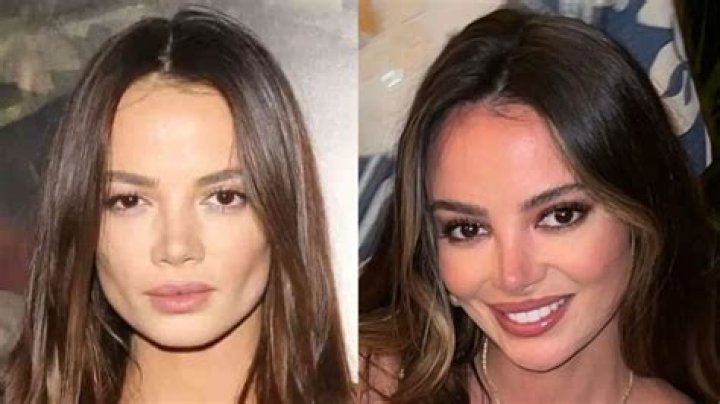 Has Keleigh Teller Undergone A Nose Job?