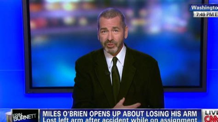 How Did Miles O’Brien Lose His Arm?