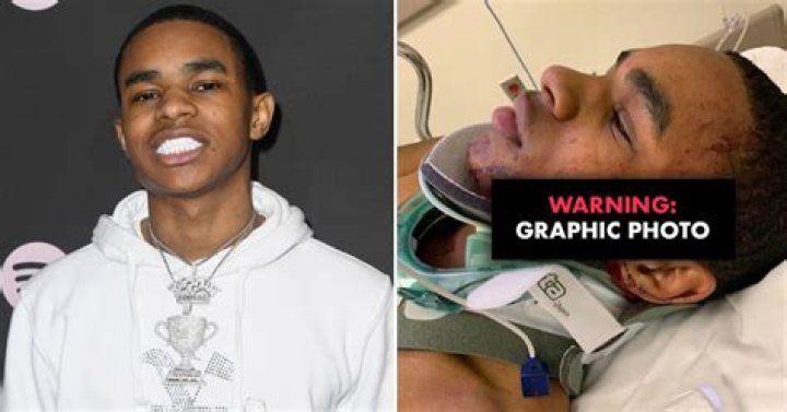 YBN Almighty Jay Requires 300 Stitches For Stab Wounds From Attack